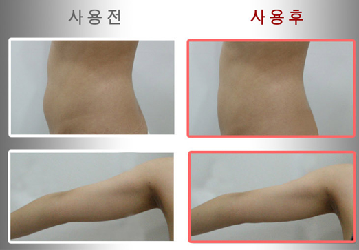 세계 11개국서 호평받은 액티브PPC크림 국내 출시