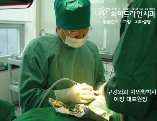 "치주염 등 치조골 소실시 임플란트, 정확한 골형성이 중요"