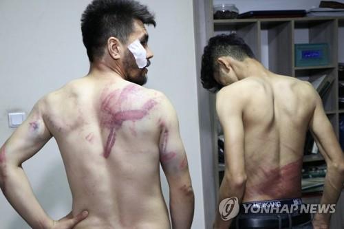 탈레반에 폭행당한 상처 보여주는 아프간 기자들. [로이터=연합뉴스]