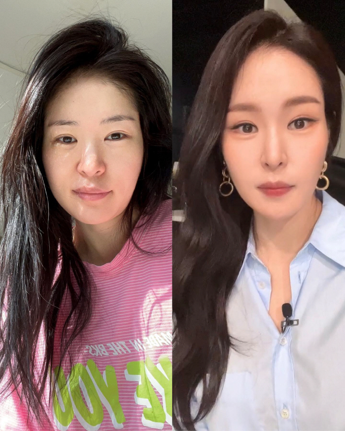 ♥김태현도 못 알아보겠어..미자, 성형 아닌 홈케어로 완성한 미모