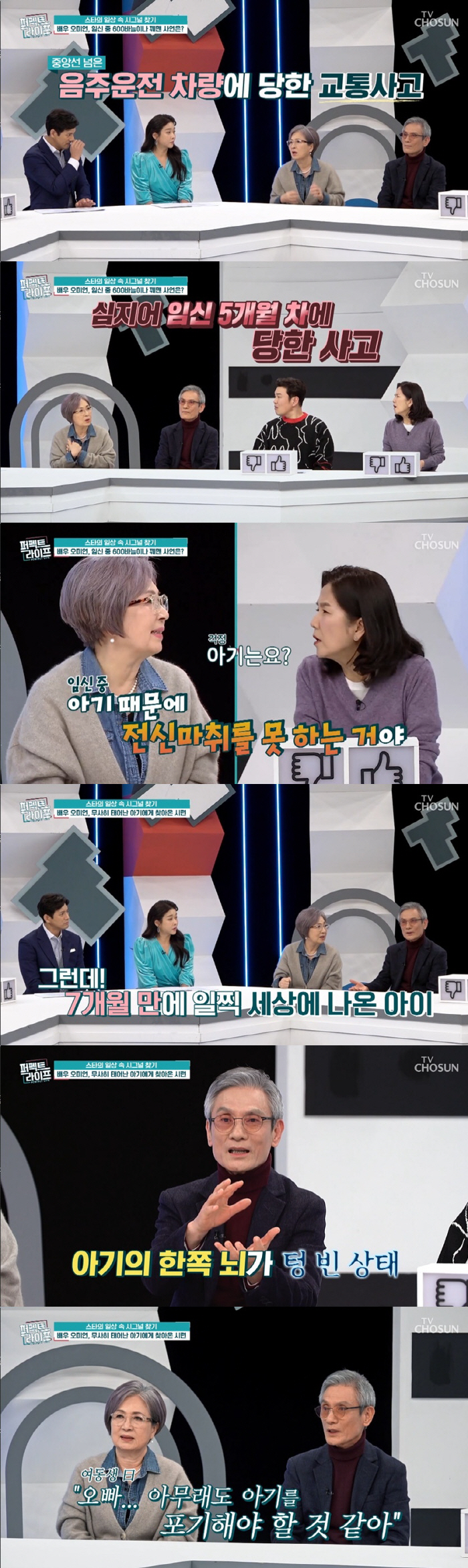 오미연 "임신 중 교통사고로 600바늘 꿰매, 전신마취도 못했다" ('퍼…