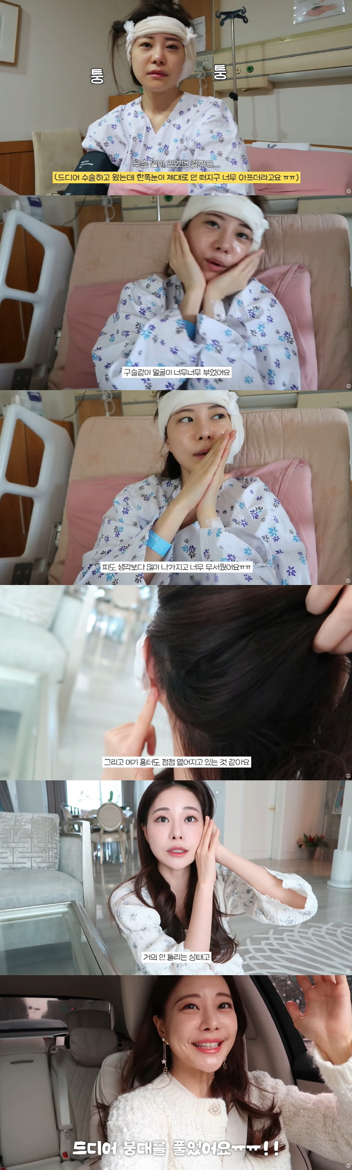 아옳이, 붕대 칭칭+부은 얼굴 "잘 버틴다 생각했는데...진주종 수술, …