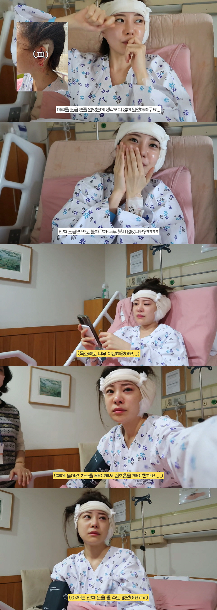 '전남편 외도폭로' 아옳이, 머리밀고 수술까지…"힘든일 多, 잘 버티고 …