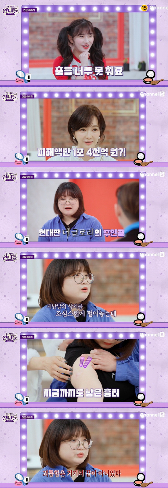 '더 글로리' 학폭=내 얘기…고데기 화상·몸 묶인 적도" 선명한 흉터 공…