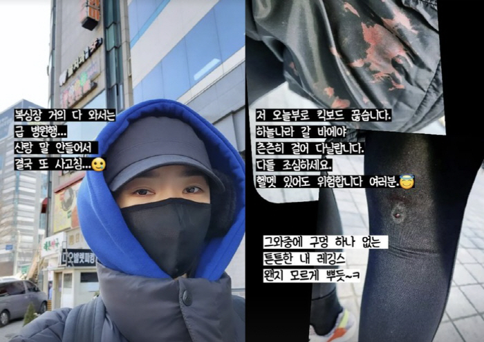 배슬기 "사고 쳐 병원비만 80만원"…충격적인 다리 상태