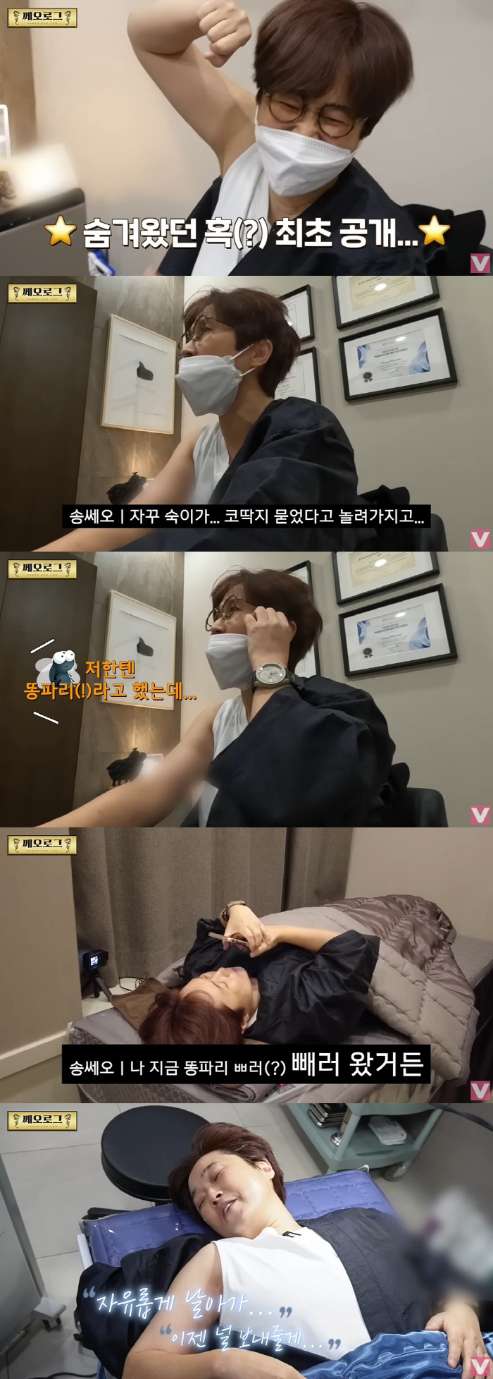송은이, 겨드랑이 번쩍 '혹' 최초 공개 "김숙 코딱지 묻었다고" ('비…