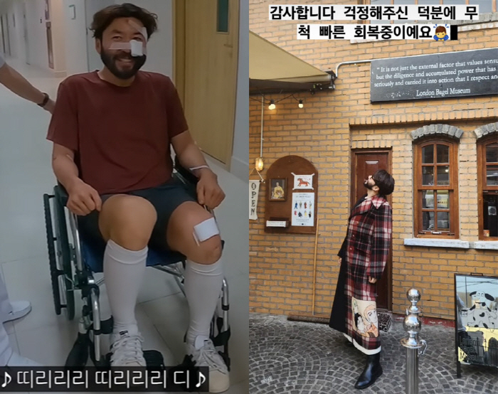 노홍철, 사고로 찢어진 얼굴 벌써 다 나았네!..“빠르게 회복 중”