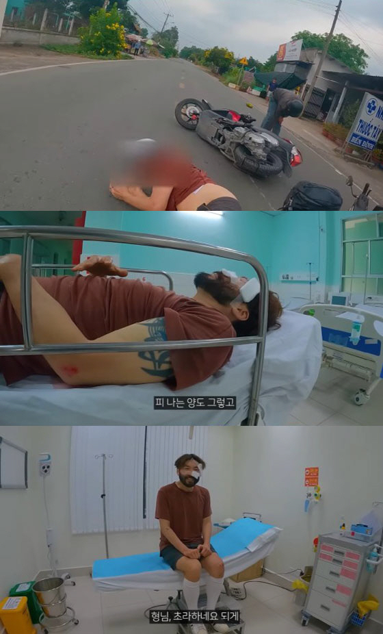 "피 많이 흘려 어질" 노홍철, '피 철철' 오토바이 사고 후 "빠르게 …