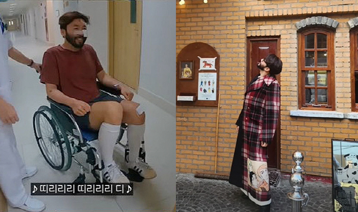 "피 많이 흘려 어질" 노홍철, '피 철철' 오토바이 사고 후 "빠르게 …