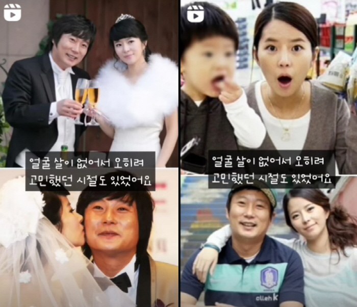 '이수근♥' 박지연, "'내 얼굴 아닌데'라 부정해"…스테로이드 부작용 …