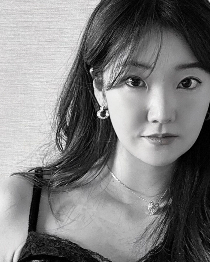 9기 옥순, 눈밑지방재배치+지방흡입 후 달라진 미모…또렷한 고양이상