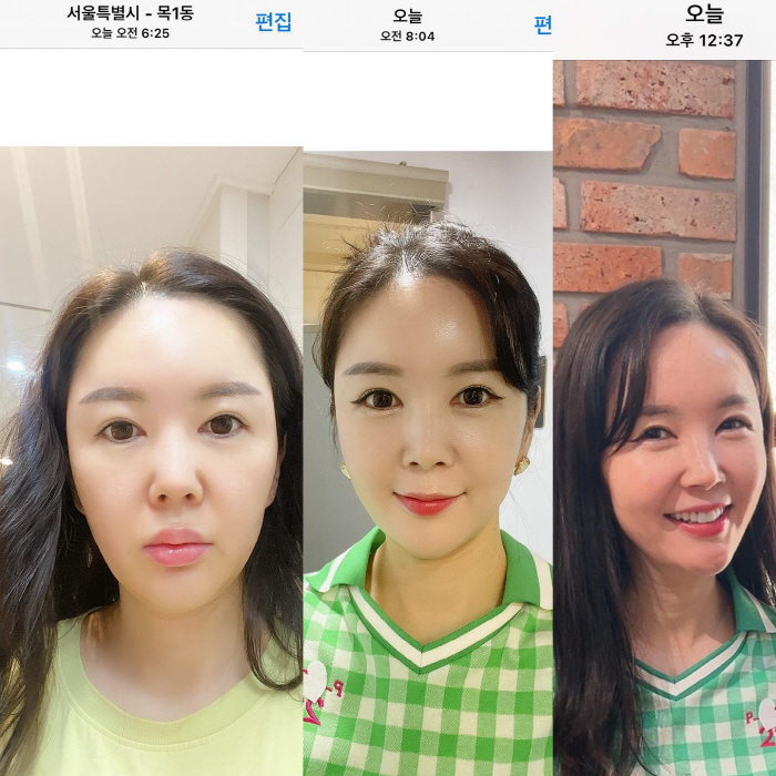 장영란, ♥ 한창에 "두 여자랑 사는 남자" 무슨 일?