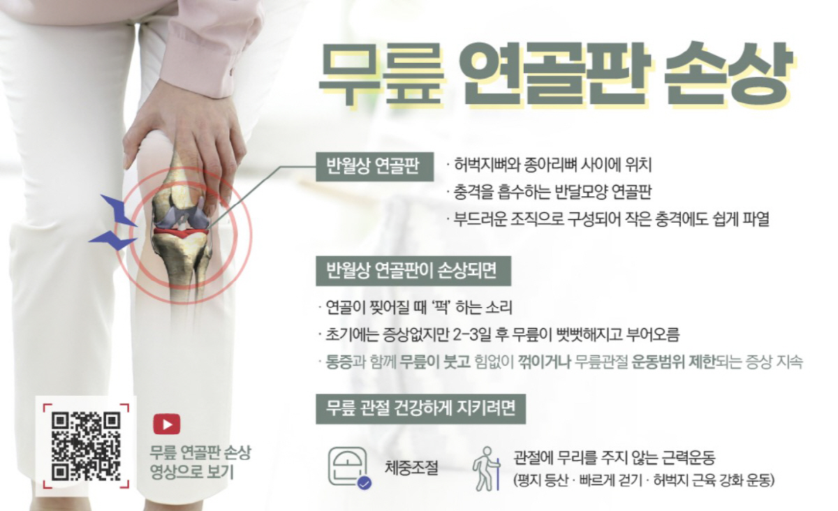 운동 중 무릎에서 '퍽', 혹시 '반월상 연골판' 파열?