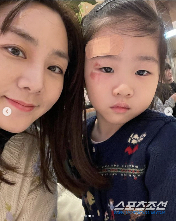 '조우종♥'정다은 아나, '6세 딸' 얼굴 다쳐 가슴이 '철렁'…눈 밑 …