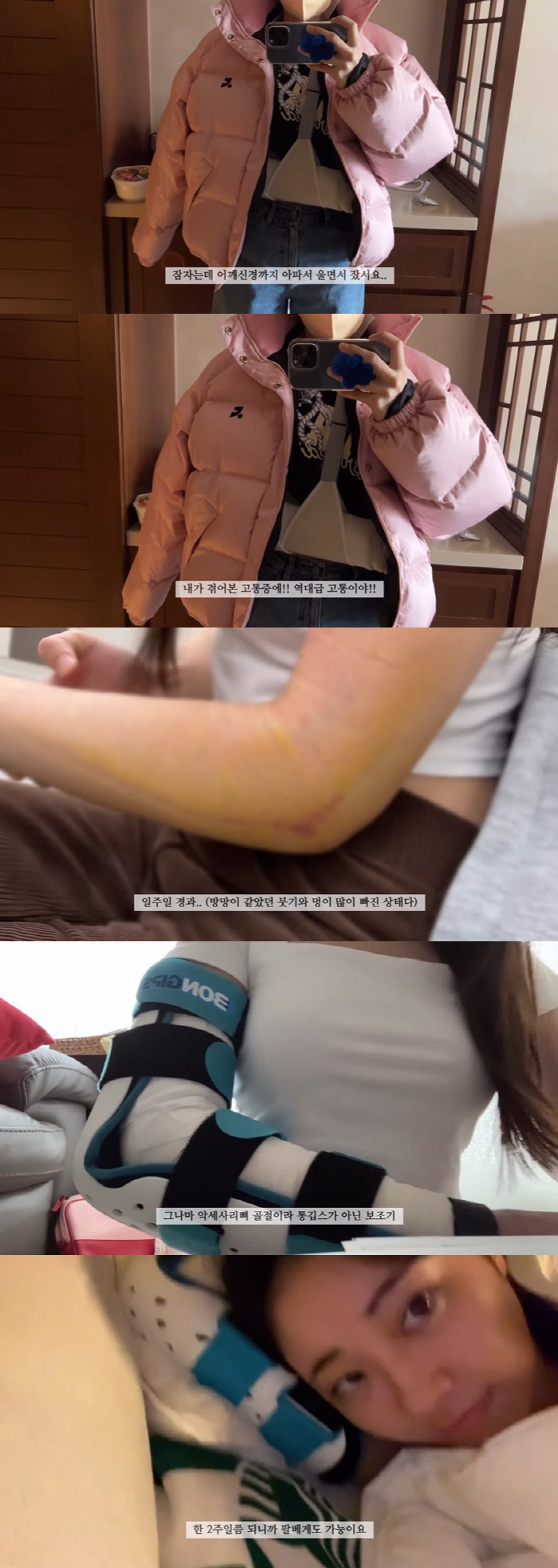 경리, 팔 골절에 역대급 고통 호소 "어깨 신경까지 아파 울어"