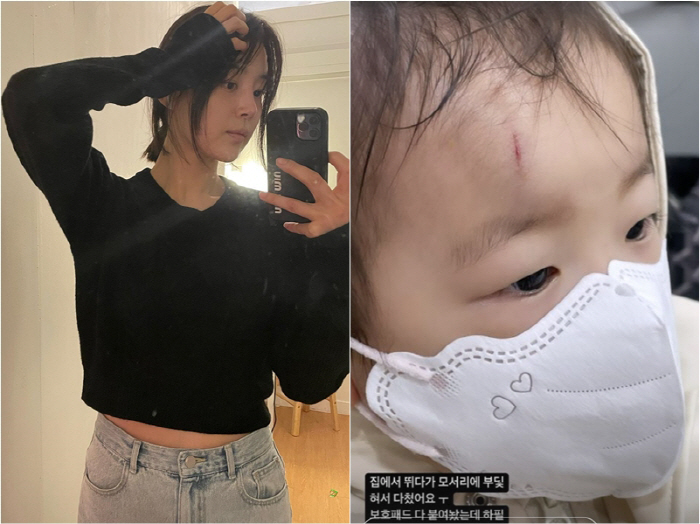 "눈뜬채 기절"→"이번엔 이마에 꽝"…한지혜 딸, 피맺힌 상처에 '간담이…