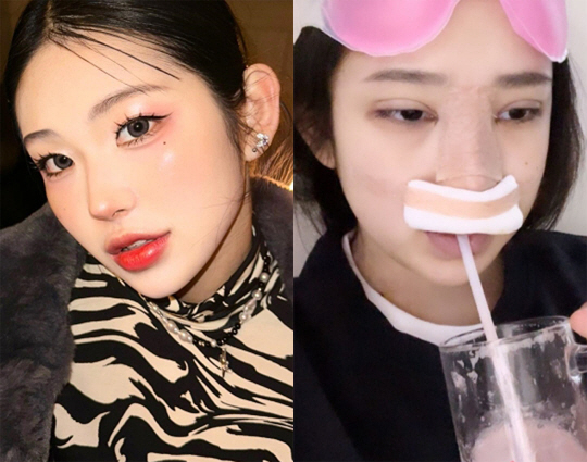 '故최진실 딸' 최준희, 눈+코 재수술 받자마자 후회 "나는 바보야"