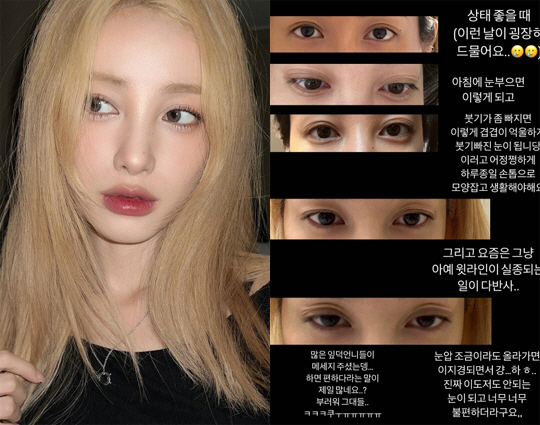 유깻잎, 가슴+얼굴 지방 이식 수술 이어 눈매 교정 수술까지 "미용 때문…