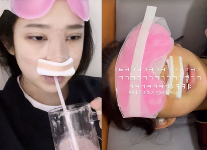 '故 최진실 딸' 최준희, 아직 21살인데 벌써 '코성형만 두 번째'…긍…