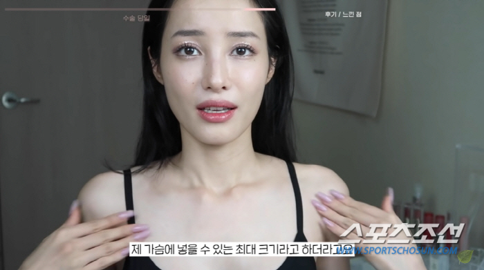 유깻잎, '가슴 성형' 공개 이어 '쌍꺼풀 수술' 예고…성형 예고 시대!