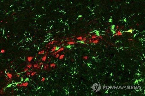 [미 록펠러대 분자·세포 신경학 랩 제공]