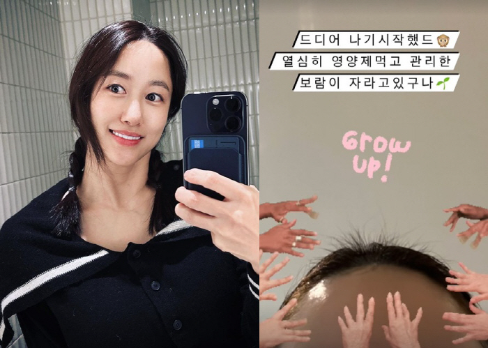전혜빈, 심각했던 '산후 탈모' 극복 "열심히 관리한 보람이 자란다"