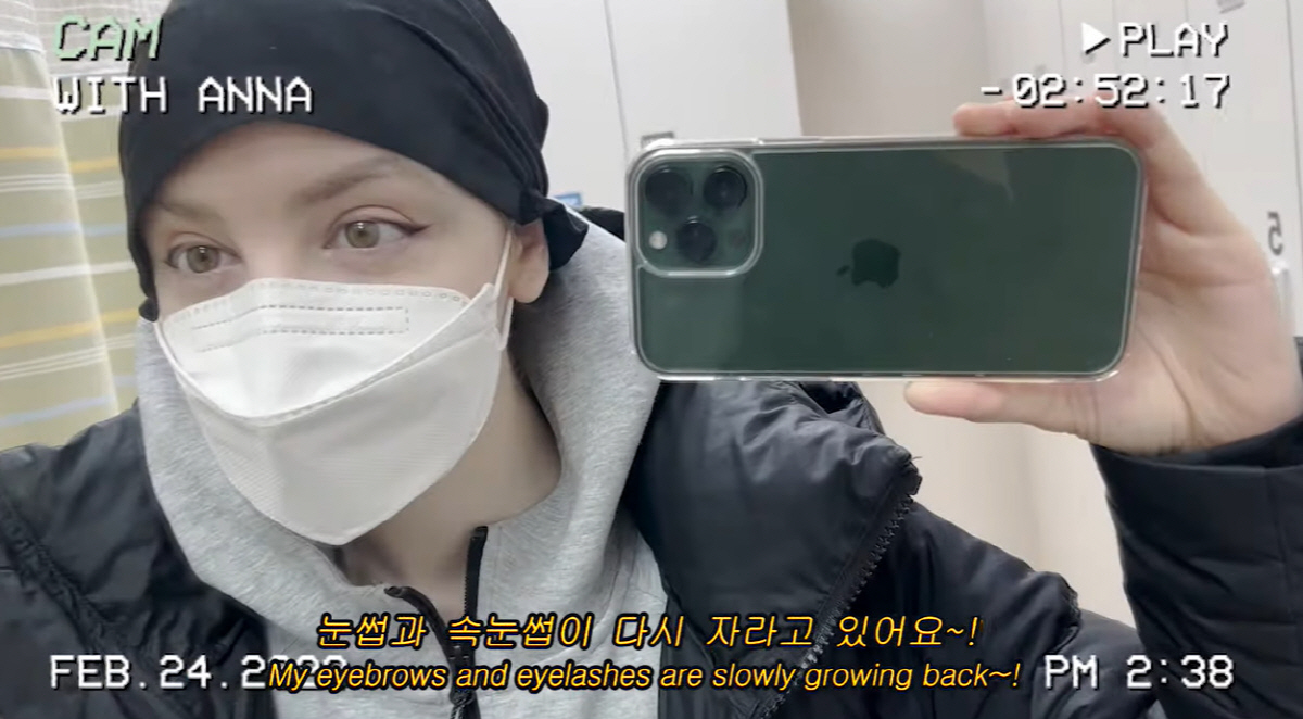 '암 투병' 안나, 방사선 치료 후 건강해진 얼굴 "눈썹·속눈썹 다시 자…