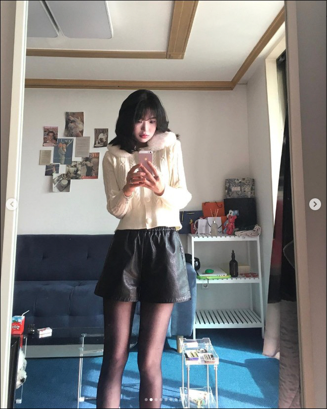 최준희, '눈코 재성형' 확 달라진 비포애프터 "성형부기 빠지는 속도 빨…
