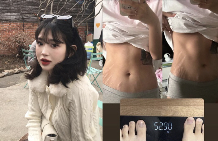 '44㎏ 감량' 최준희, 배에 생긴 튼살 공개…당당한 MZ세대