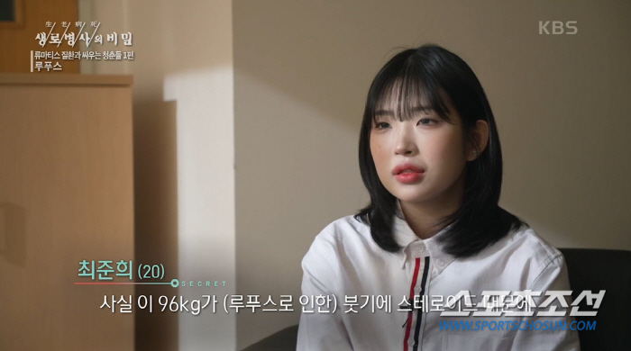 '루푸스로 96㎏까지 쪘던' 최준희, 투병 과정 공개…"평생 야생 늑대를…