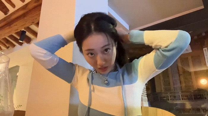 경리 팔꿈치 골절 "다행히 회복속도 좋아, 생활하는데 무리 없어"('경리…
