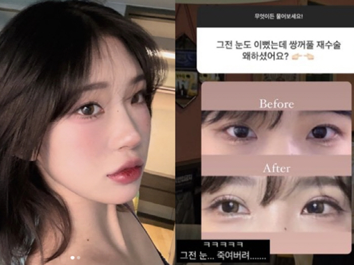 '故 최진실 딸' 최준희, "수술 전 눈 예뻤는데" 반응에 "죽여버려 그…