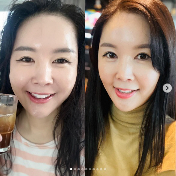 '한창♥' 장영란, 부기 유무 따라 180도 다른 얼굴…"누구?"