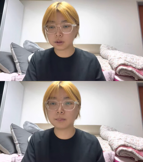 10기 영자, '양악 수술' 한 이유 "외모 악플 타격 커, 수입도 없고…