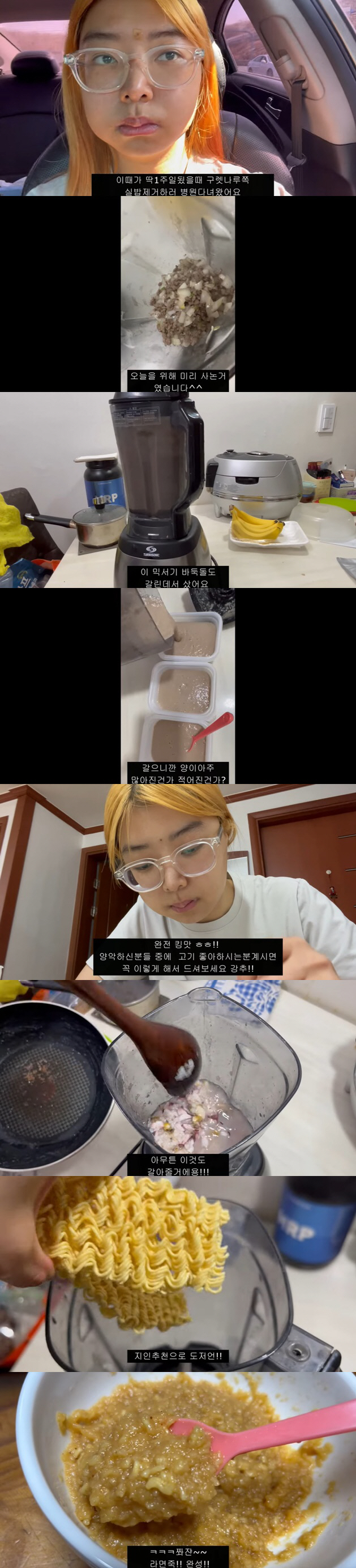 10기 영자, '양악 수술' 했지만 우울 "이래서 재혼 못하나"..달라진…