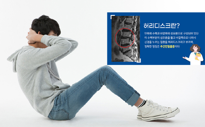 잘못된 유튜브 척추 운동 영상, 오히려 '디스크' 위험