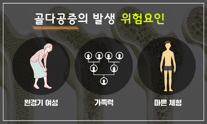 완치 없는 골다공증, 걸리기 쉬운 '3가지' 유형