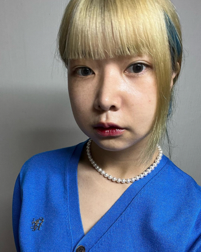 10기 영자, '양악 수술' 한 달도 안 됐는데…확 달라진 비주얼