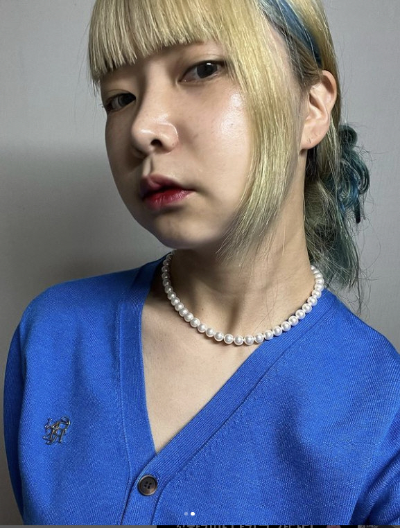 10기 영자, '양악 수술' 한 달도 안 됐는데…확 달라진 비주얼