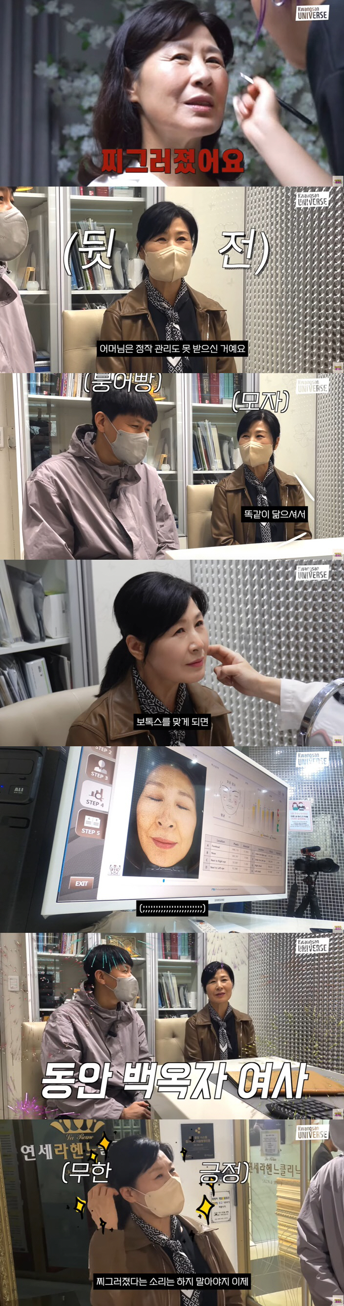 김승현 母, 찌그러진 얼굴 시술로 쫙 폈다 "눈물 날 것 같아"('김승현…