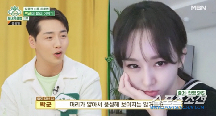 박군, 'M자 탈모' 20대 공개에 '충격'…'♥한영'도 탈모 고민 중!