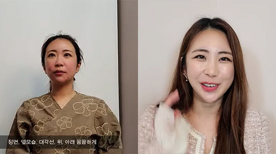김성은 "코 재건 6시간 대수술 성공, 이미지 달라지지 않아 만족" ('…