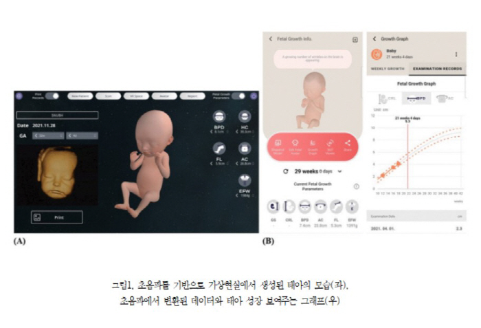 "VR 태아 영상 본 산모, 태아와 유대감 더 높아져"