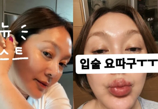 이승연, 입술이 왜 이래? '퉁퉁 붓고 붉은 점' 심각해…"입술 요따구"