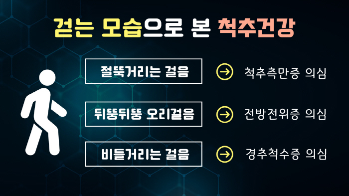 뒤뚱뒤뚱·비틀비틀…걷는 모습 보면 '척추 질환' 보인다