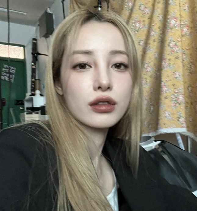 유깻잎, '세 번째 성형'에 쏟아지는 관심 "지금 4일차…턱에 붓기 내려…