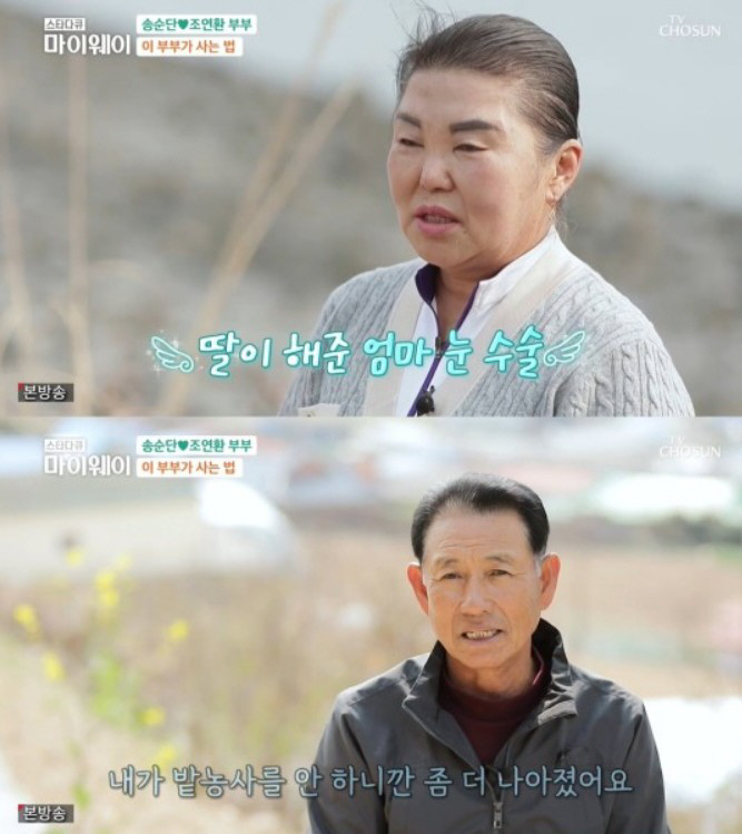 송가인, 母 위해 성형→외제차까지...급이 다른 '효도 FLEX'