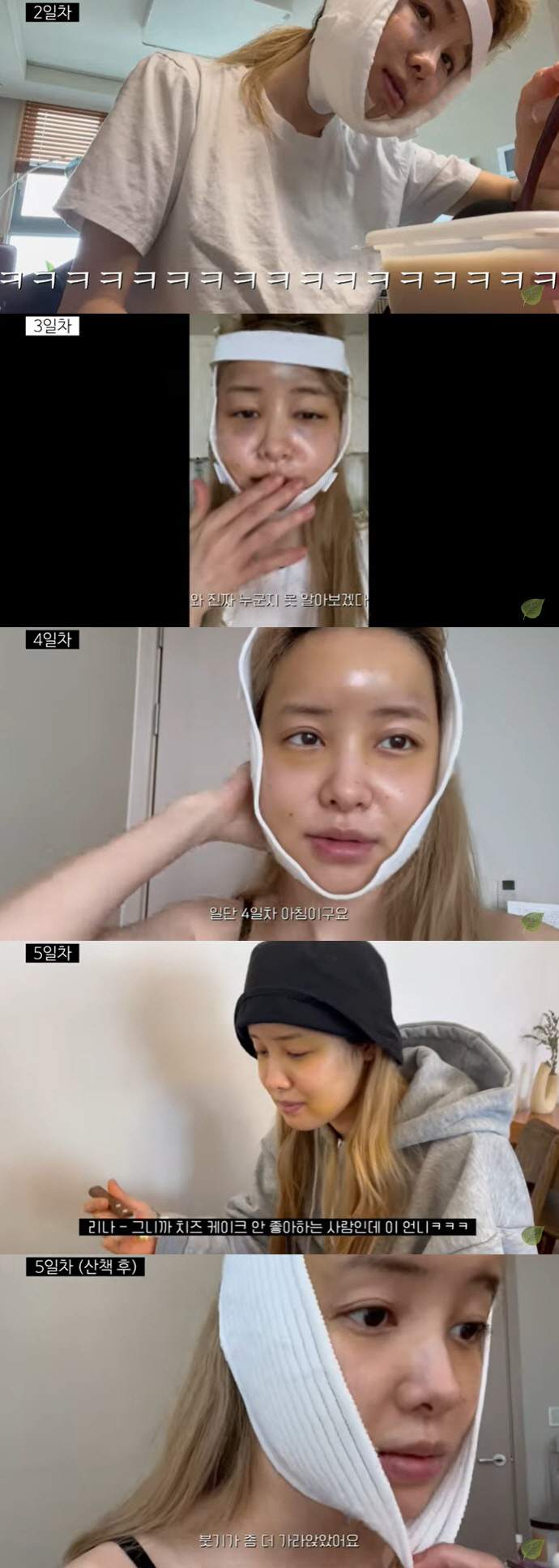 유깻잎, '안면윤곽+지방이식' 6시간 대수술 과정 "아픔 가늠 안돼" […