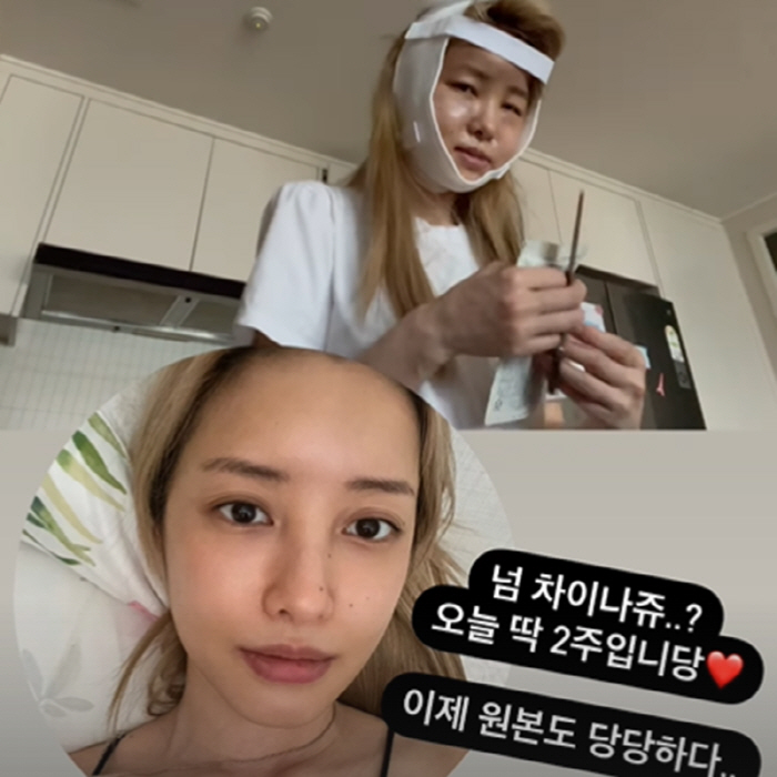 유깻잎, "와 진짜 누군지 못알아보겠다"…성형 후 "이제 원본사진도 당당…