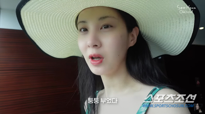 '괌' 여행 서현, 얼마나 먹고 잤는지 얼굴이 '퉁퉁'! 화장 비법이 있…
